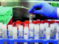 Κορωνοϊός: 22.107 νέα κρούσματα - Κάτω α...