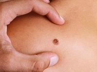 Ενημερωτική εκστρατεία για την πρόληψη τ...