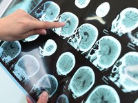 Πανευρωπαϊκή μελέτη για εξέταση ακριβεία...