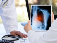 ΠΟΥ: «Ο long Covid καταστρέφει τις ζωές ...