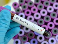 Όλα όσα θέλετε να ξέρετε για τον κορωνοϊ...