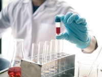 Οι μισοί θάνατοι από καρκίνο οφείλονται ...