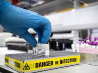 Κορωνοϊός: 17 νέα κρούσματα στην Αχαΐα, ...