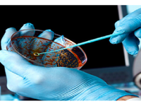 Ινστιτούτο Παστέρ: Ίσως και το φθινόπωρο...