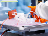 Ευλογιά των πιθήκων: Ανοιχτό το σενάριο ...