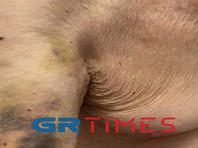 98χρονος υποστηρίζει ότι έπεσε θύμα κακο...