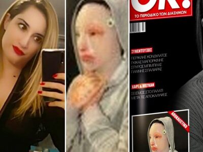 Επίθεση με βιτριόλι: Ο αδιανόητος Γολγοθ...