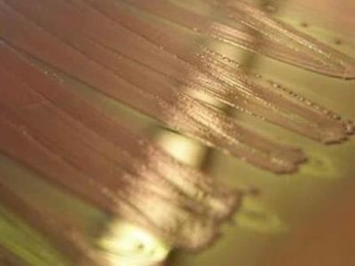 Επιστήμονες δημιούργησαν «ζωντανά υλικά»...