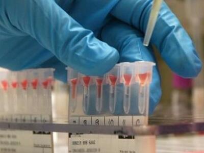 Η ομάδα αίματος σχετίζεται με προβλήματα...