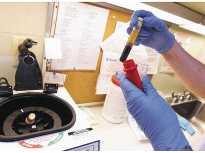 Πάτρα: Στα Ψηλά Αλώνια σήμερα η κινητή μ...