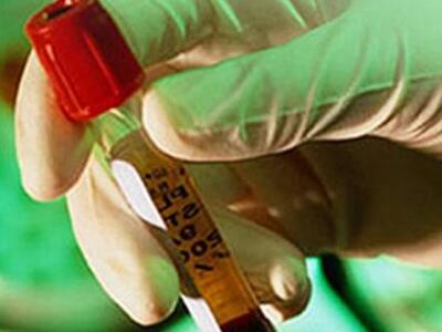 Δυτική Ελλάδα: Κλειστά αύριο τα αντιδρασ...