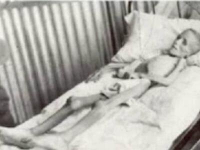 Βίντεο ΣΟΚ - Τα πειραματόζωα του Χίτλερ