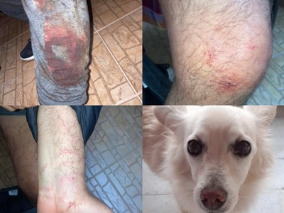 Πάτρα: Σοκαριστική επίθεση από πιτ μπουλ...