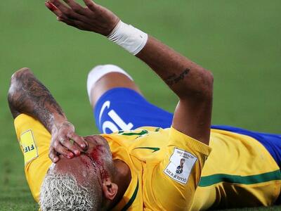 Ποδόσφαιρο: "Ματωμένος" θρίαμβ...