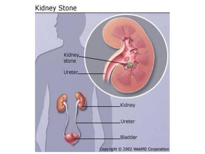 Νέα ανακάλυψη προσφέρει ελπίδες ότι θα ε...