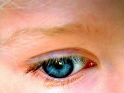 Στα «αζήτητα» παιδάκι 2,5 χρόνων-Περιφερ...