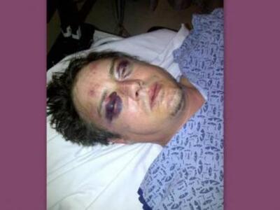 Σοκαριστική φωτογραφία ηθοποιού που τον ...