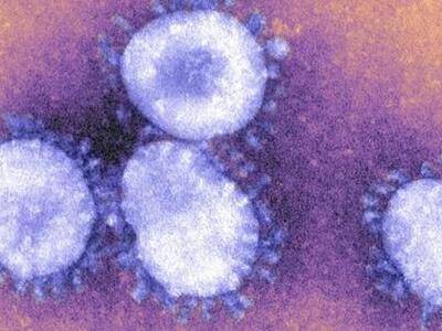 Κρίσιμη η κατάσταση της υγείας του 69χρο...