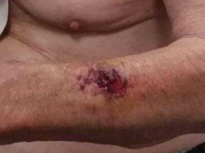 Δυτ. Ελλάδα: Ανελέητα τα χτυπήματα των λ...