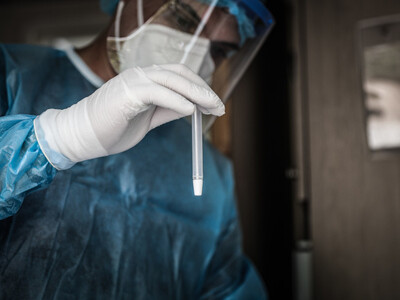 Κορωνοϊός: «Πιθανό να προκαλέσει ανοσιακ...