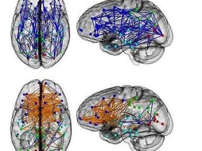 Διαφορετική «καλωδίωση» - Οι άνδρες εκτε...