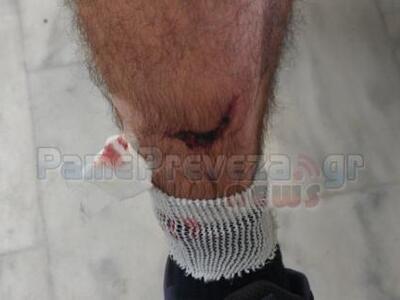 Πρέβεζα: Του επιτέθηκαν τέσσερα αδέσποτα...