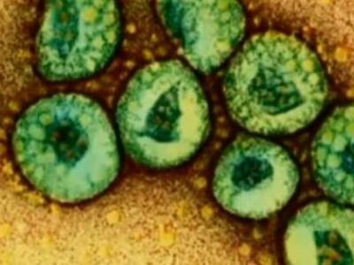 Κορονοϊος MERS: Καραντίνα για όσους ήρθα...