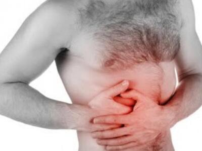 Πολύποδες παχέος εντέρου: Όλα όσα πρέπει να ξέρετε