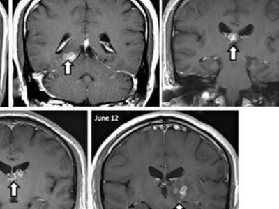 Σκουλίκι-ταινία ζούσε επί χρόνια στον εγ...