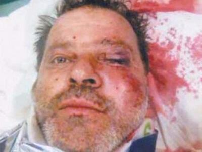 Ζάκυνθος: Υπάλληλοι της ΔΕΗ έκοψαν ρεύμα...