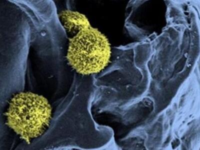 Πιο κοντά στον τεχνητό μυελό των οστών