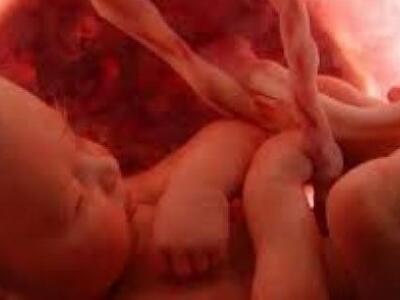 Άτομο με ψυχολογικά προβλήματα η 38χρονη...