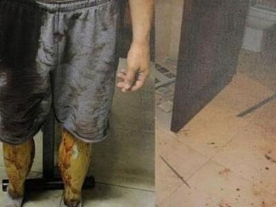 Φωτογραφίες-σοκ που δείχνουν τον Πιστόρι...