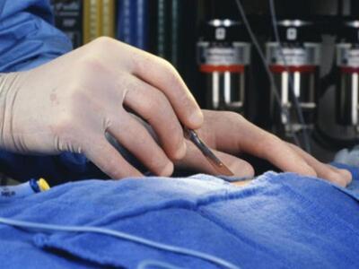 «Τέλος» τα τακτικά χειρουργεία στο Νοσοκ...