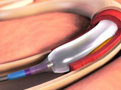 Βιοδιασπώμενες ηλεκτρονικές συσκευές που...