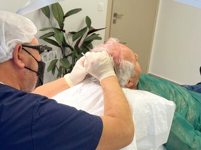 Δωρεάν ενημέρωση για μεταμόσχευση μαλλιώ...