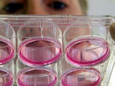 Φως στους βιολογικούς μηχανισμούς του Αλ...