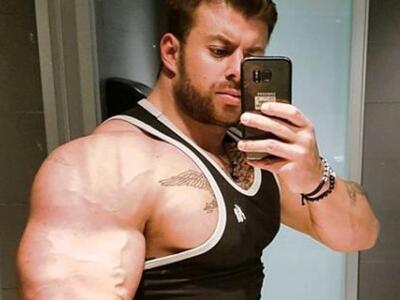 Ιταλία: Μπόντι-μπίλντερ έφαγε το αυτί ταξιτζή 