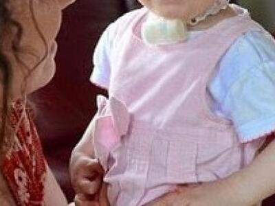 Tο κοριτσάκι 17 μηνών που γεννήθηκε χωρίς μύτη!