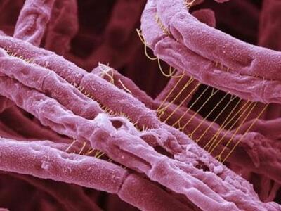 Δεν αποκλείεται η επιστροφή της θανατηφό...