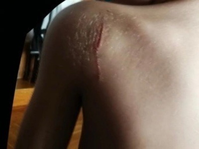 Θεσσαλονίκη: Μαχαίρωσαν μαθητή με φαλτσέ...