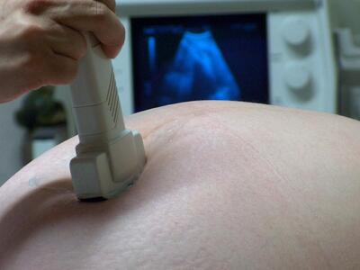 Φόβος στις ΗΠΑ: 157 έγκυες έχουν μολυνθε...