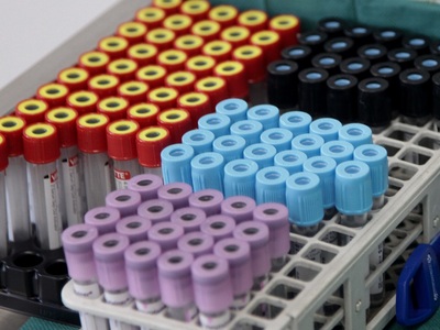 Κίνα: 18 νέα κρούσματα κορωνοϊού, τις τε...