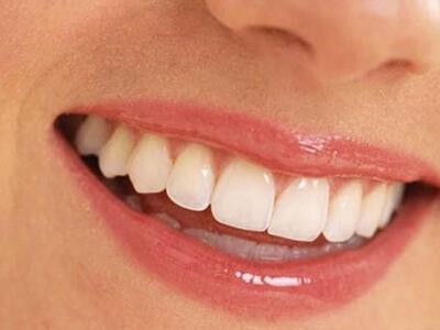 Χρήσιμες συμβουλές για τον...πονόδοντο 