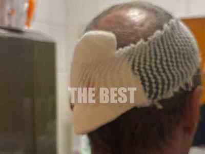 Ψαθόπυργος: Έκανε βόλτα στην παραλία με ...