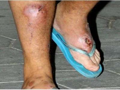 Ποιος ηθοποιός κυκλοφορεί δημόσια έτσι;