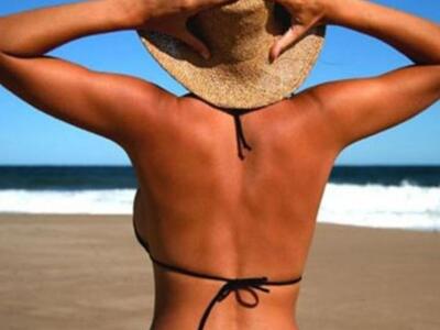 Πώς θα αντιμετωπίσετε τα εγκαύματα από τον ήλιο;