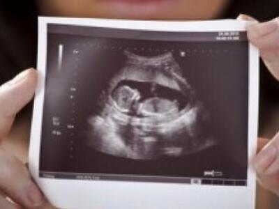 Μωρό επιβιώνει από έκτρωση που έγινε με ...