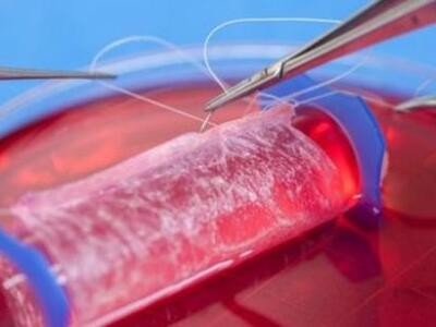 Μεταμοσχεύθηκε γυναικείος κόλπος που είχ...