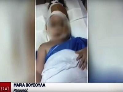 Πιτ μπουλ δάγκωσε στο πρόσωπο κοριτσάκι ...